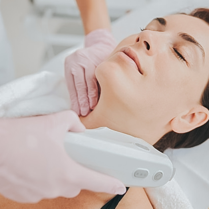 Ultherapy neck treatment