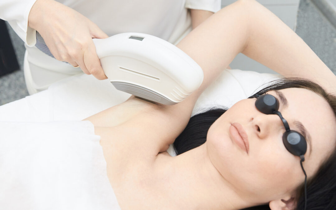 7 Benefits of Laser Hair Removal Treatment