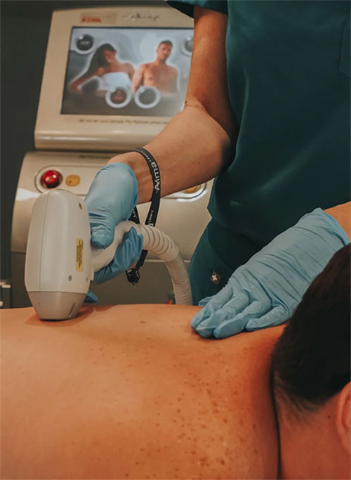 Lasers treatment in St. Joseph